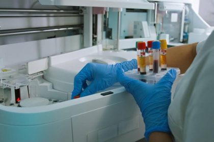 A blood sample in a laboratory