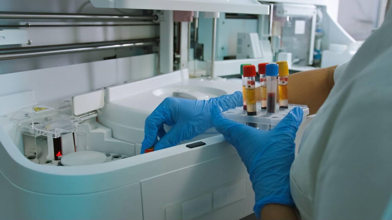 A blood sample in a laboratory